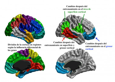 <p>La comparativa reveló los cambios estructurales en el cerebro. / UAM</p>