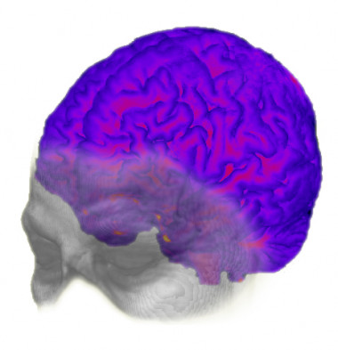 <p>Representación evolutiva del cerebro del <em>Homo sapiens</em>. / CENIEH.</p>