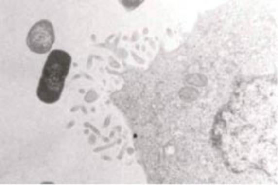 <p><a href="http://www.plataformasinc.es/index.php/esl/imagenes/inicio/(imagen)/32262" target="_self">Lactobacilo (<em>Lactobacillus gasseri</em>, la silueta más oscura) captado por una célula del sistema inmune (célula dendrítica) </a>para ser transportado a la glándula mamaria. Foto: Susana Langa.</p>