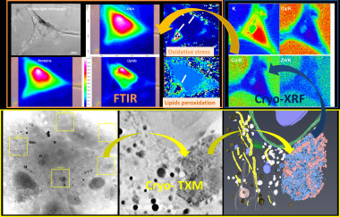 <p>Arriba a la izquierda, los datos de microespectroscopia de infrarrojo mediante transformada de Fourier indican el estrés oxidativo en los astrocitos. Arriba a la derecha, mapas de criofluorescencia de rayos X muestran la distribución de metales. Debajo, la tomografía de rayos X y su reconstrucción 3D muestran los cambios estructurales. / Tanja Dučić <em>et al</em></p>