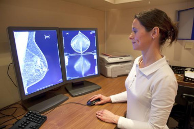 <p>En la mamografía digital la película de rayos X es reemplazada por sistemas electrónicos más precisos. / Fotolia</p>