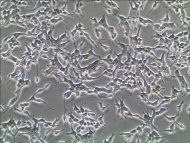 <p>Foto de un cultivo de células tumorales pancreáticas AR42J. / UEx</p>