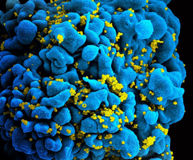<p>Partículas de VIH infectando a un linfocito T. / <a href="https://commons.wikimedia.org/wiki/File:HIV_H9_T-cell.jpg" target="_blank">National Institutes of Health (NIH)</a>.</p>
