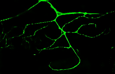 <p>Célula ramificada de la traquea de la larva de Drosophila marcada con GFP / Delia Ricolo, IRB Barcelona</p>