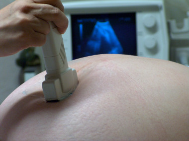 <p>La obesidad en las mujeres embarazadas puede ser un potencial factor de riesgo del asma. / <a href="http://www.sxc.hu/photo/676878" target="_blank">Jeinny Solis S</a>.</p>