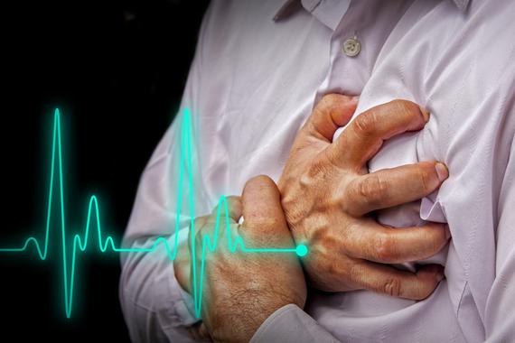 <p>La extensión y la severidad de la periodontitis crónica se relaciona con el tamaño del infarto agudo de miocardio. / Fotolia</p>