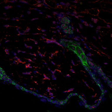 <p>Imagen de microscopía confocal de la barrera de la piel (en verde), folículo piloso (en verde) y los fibroblastos (en rojo). En azul, los núcleos celulares. / Marion Salzer, IRB Barcelona</p>