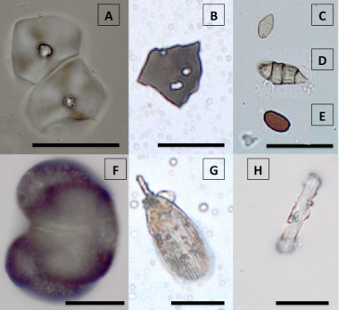 <p>Microfósiles extraídos de la placa dental de individuos de la Cueva de Qesem (Israel). / UAB</p>