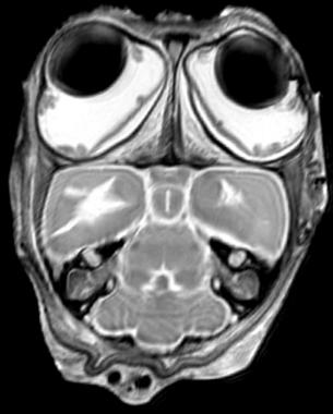 <p><a href="http://www.plataformasinc.es/index.php/esl/imagenes/inicio/(imagen)/45342" target="_self">Resonancia magnética de un gato</a> (<em>Tarsius bancanus</em>). Foto: Universidad de Liverpool.</p>