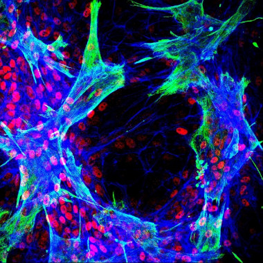 <p>Imagen de inmunofluorescencia que muestra células estrelladas hepáticas primarias humanas que interactúan con células progenitoras hepáticas bipotentes <em>in vitro</em>. Los cultivos se marcaron utilizando anticuerpos contra vimentina (verde), HNF4a (rojo) y se trataron con faloidina (azul). El estudio mostró que la diferenciación de las células progenitoras se localizó en los sitios de contacto entre los dos tipos de células. / Luke Noon</p>
