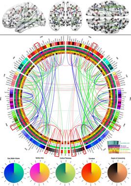 <p>Representación gráfica de la conectividad del cerebro humano. / USC Institute for Neuroimaging and Informatics</p>