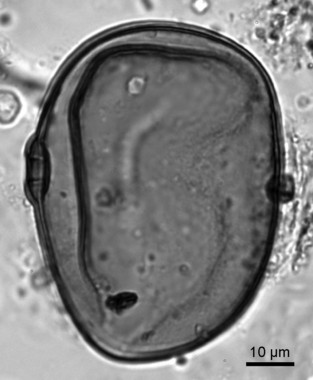<p>Detalle de un grano de polen de centeno recuperado de los sedimentos del Lago Azul / Valentí Rull, ICTJA-CSIC</p>