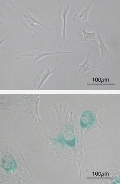 <p>Fibroblastos embrionarios de ratón antes (arriba) y después de la senescencia (abajo). / <a href="http://en.wikipedia.org/wiki/File:SABG_MEFs.jpg" target="_blank">Wikipedia</a></p>