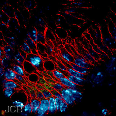 <p>Células epiteliales. Imagen: JCB</p>