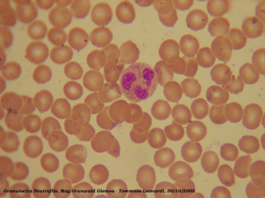 <p>Neutrófilo en un frotis sanguíneo, rodeado de glóbulos rojos. / <a href="http://commons.wikimedia.org/wiki/File:Neutrophil.jpg" target="_blank">Wikipedia</a></p>