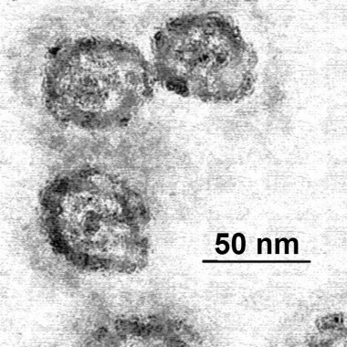 <p>Microscopia electrónica de transmisión del virus de la hepatitis C. / <a href="https://es.wikipedia.org/wiki/Hepatitis_C#/media/File:Em_flavavirus-HCV_samp1c.jpg" target="_blank">Wikipedia</a></p>