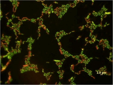 <p>Ampliación de la <em>E. coli</em> expuesta a una baja concentración (10 mg/l) de nanopartículas de dióxido de titanio. Las células con membranas deterioradas presentan una coloración roja. <a href="http://plataformasinc.es/index.php/esl/Multimedia/Imagenes/Galeria-de-actualidad-del-23-al-27-de-marzo-2009/Las-nanoparticulas-de-los-cosmeticos-pueden-danar-el-medio-ambiente" target="_self">Foto: Universidad de Toledo (Ohio, EE UU).</a></p>