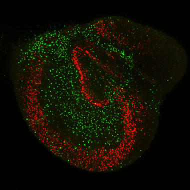 <p>Imagen de fluorescencia de una rodaja cultivada de hipocampo de rata donde se muestran los somas de las neuronas (en rojo) y de los astrocitos (en verde). / CSIC</p>