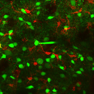 <p>Imagen de microscopía confocal donde se muestran neuronas (verde) y astrocitos (rojo). /(CSIC)</p>