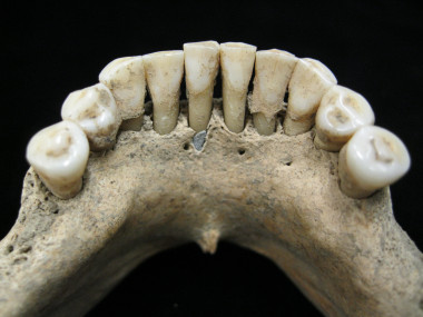 <p>Pigmento de lapislázuli atrapado en el cálculo dental de la mandíbula inferior de una mujer medieval / Christina Warinner</p>