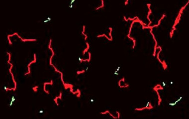 <p>Trayectorias de espermatozoides en movimiento observadas con un sistema de microscopía que incorpora análisis asistido por ordenador. / MNCN</p>