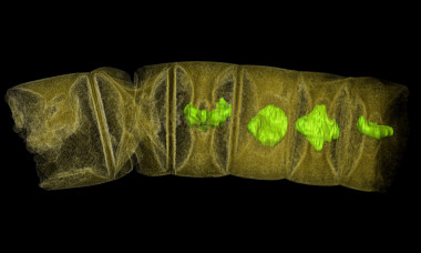 <p>Imagen tomográfica por rayos X de algas rojas fósiles estudiadas en el trabajo / Stefan Bengtson</p>