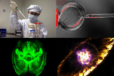 <p>De arriba a abajo y de izquierda a derecha: un científico investiga el virus H7N9, una célula madre embrionaria, el cerebro transparente de un ratón y la representación de la explosión de una supernova. / Varios</p>