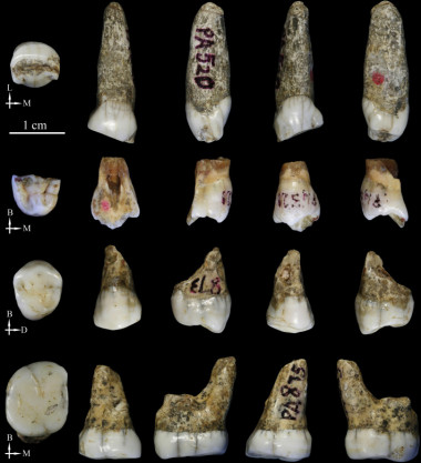 <p>Los cuatro dientes de Tongzi. / Song Xing et al</p>