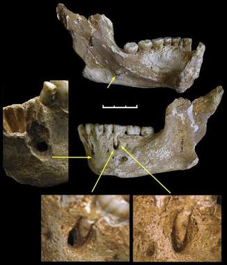 <p>Marcas en los dientes que demuestran el uso preferente de la mano. / PLoS One</p>