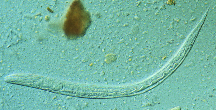 <p>Larva del helminto intestinal <em>Strongyloides stercoralis </em>/ CDC</p>