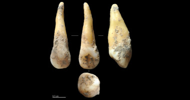 <p>Diente hallado en Cova Bonica, de 7.400 años de antigüedad. / Joan Daura / Montserrat Sanz.</p>