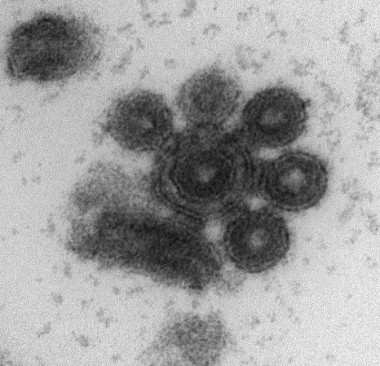 <p>Micrografía electrónica que muestra la agregación espontánea de viriones purificados. Seis viriones, cinco de ellos en transección, rodean a un virión central que presenta una doble bicapa de lípidos / UV</p>