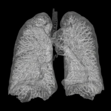 
<!-- START: including template: extension/sinc/design/ezwebin/templates/content/datatype/view/ezxmltags/paragraph.tpl (design:content/datatype/view/ezxmltags/paragraph.tpl) -->
<p>Pulmones. Foto: Andreas Heinemann.</p>
<!-- STOP: including template: extension/sinc/design/ezwebin/templates/content/datatype/view/ezxmltags/paragraph.tpl (design:content/datatype/view/ezxmltags/paragraph.tpl) -->
