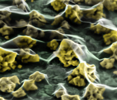 <p>Nanopartículas de oro en el nuevo sistema híbrido. / UCO</p>