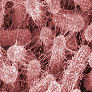 <p>En la imagen, <em>Klebsiella pneumoniae</em>. / <a href="http://www.flickr.com/photos/ajc1/3787968951/sizes/m/in/photostream/" target="_blank">AJ Cann</a></p>