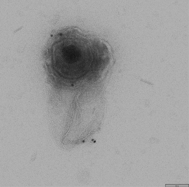 <p>InmunoelectromicroscopÃa de microvesÃculas obtenidas a partir de células HOG infectadas con HSV-1. La imagen muestra una microvesÃcula (marcada con un anticuerpo anti HSV-1 acoplado a oro coloidal) conteniendo un virión. | UAM</p>