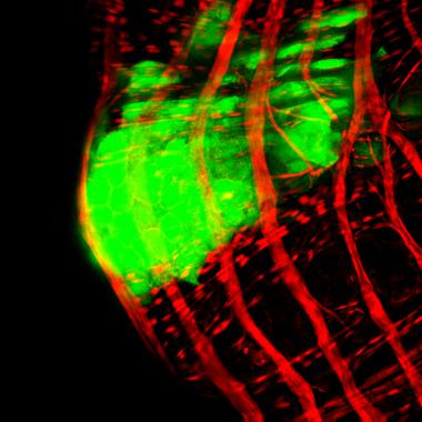 <p>En verde, detalle de un tumor rodeado de fibras musculares del intestino de Drosophila, en rojo. / O Martorell (IRB Barcelona)</p>