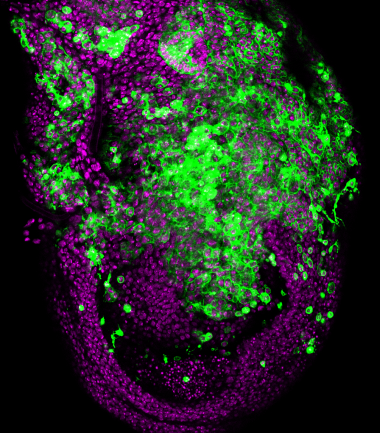 <p>Epitelio de <em>Drosophila melanogaster</em> sometido a inestabilidad cromosómica (CIN): las células comienzan a invadir los tejidos vecinos. En magenta, núcleos del epitelio y, en verde, membranas de las células sometidas a CIN. / Lara Barrio, IRB Barcelona</p>
