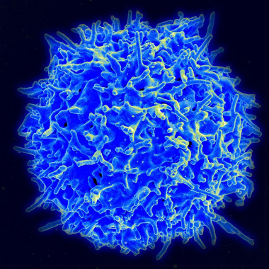 <p>Micrografía de un linfocito T humano, también llamado célula T, del sistema inmune de un donador sano. / <a href="http://www.niaid.nih.gov/" target="_blank">NIAID/NIH</a> <a href="http://www.flickr.com/photos/niaid/" target="_blank">NIAID Flickr