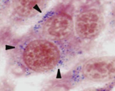 <p>Nanopartículas en el interior de células tumorales en cultivo. Foto: CNB.</p>