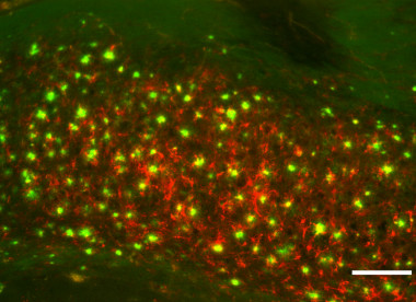 <p>Sección de cerebro de un ratón transgénico con alzhéimer mostrando acumulaciones de placas amiloides (verde) y ferritina (rojo). Barra de escala: 100mm. /<em> <em>ACS Chemical Neuroscience</em></em></p>