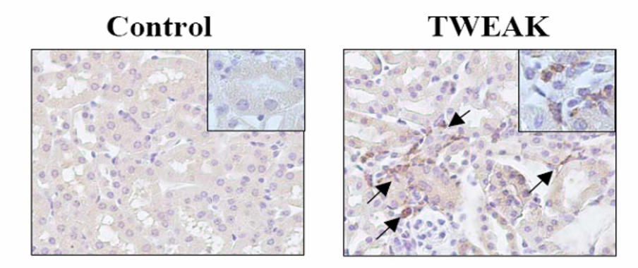 <p><strong>TWEAK promueve la inflamación del riñón:</strong> La inyección de TWEAK en ratones desencadena inflamación en el riñón, caracterizada por la presencia de leucocitos macrófagos, teñidos de marrón (flechas). </p>