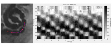 <p>Porción de un intestino con puntos de control y mapa espacio-temporal del movimiento que se genera con el nuevo sistema de análisis automatizado. / URJC</p>