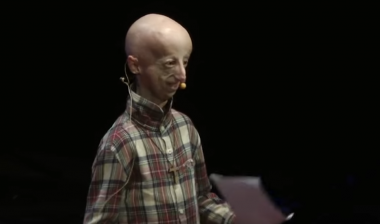 <p>Sammy Basso, el graduado en Biología que ha participado en los estudios, durante una charla TedX.</p>