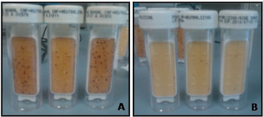 <p>Placas de cultivo donde se observa que la concentración de microorganismos en la capa de agua de la parte inferior de los depósitos (A) es significativamente mayor que en el propio gasóleo (B). / URJC</p>