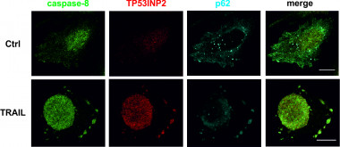 <p>Diferentes localizaciones de las proteínas involucradas en apoptosis en condiciones basales (Ctrl) y con inducción de los receptores de muerte celular con TRAIL. / Saška Ivanova, IRB Barcelona.  </p>