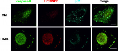 <p>Diferentes localizaciones de las proteínas involucradas en apoptosis en condiciones basales (Ctrl) y con inducción de los receptores de muerte celular con TRAIL. / Saška Ivanova, IRB Barcelona. </p>
