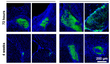 <p>Imágenes de microscopia de fluorescencia mostrando células madre (en verde) injertadas en el tejido cerebral (azul). Los cuatro cuadros de la izquierda muestran la supervivencia de células madre implantadas sin encapsular, y los cuatro de la derecha la de células encapsuladas en hidrogeles de fibroína de la seda. / <em>Front Cell Neurosci</em></p>