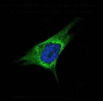 <p class=" text-left">Expresión de LOXL2 en una línea celular de carcinoma de mama de tipo basal, mostrando su intensa tinción (verde) rodeando al núcleo (azul). / UAM</p>