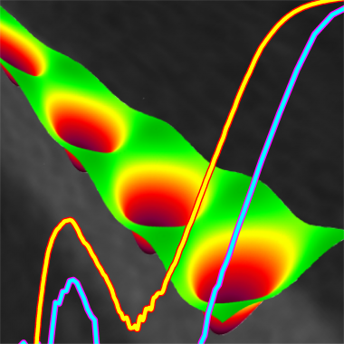 <p>Resistencia en función del campo magnético en un nanohilo superconductor con una sola fila de vórtices. / UZ.</p>